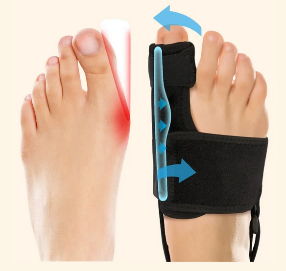 OrthoToe - Verlicht pijn direct - Set van 2