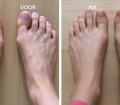 OrthoToe - Verlicht pijn direct - Set van 2
